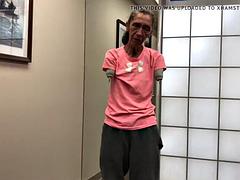 Mature double arm amputee