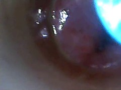 test tube cock endoscope POV urethral insertion ball rod