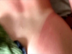 Little Step Sisters Sun Burn Accident - Arabella Rose And Alex Adams