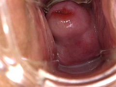 美女, フェティッシュ, 婦人科